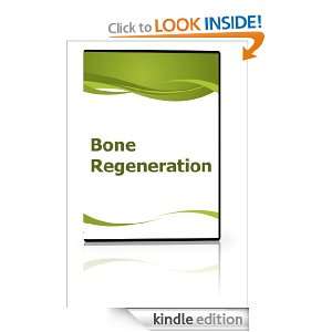 Bone Regeneration Nivaldo Alonso  Kindle Store