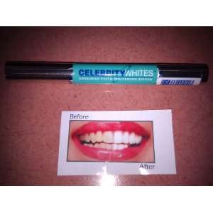   On The Go Advanced Teeth Whitening system