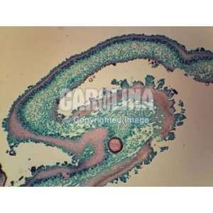 Lichen, macerated Microscope Slide  Industrial 