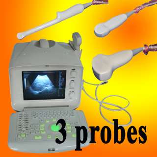 probes CE High Resolution Portable Ultrasound Scanner Ultrasound 